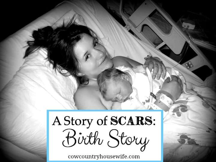 A Story of Scars Birth Story - Cow Country Housewife